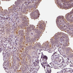 Anti-IQCB1 Antibody