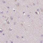 Anti-TREH Antibody