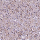 Anti-C14orf79 Antibody