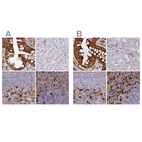 Anti-APOBR Antibody