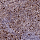 Anti-APOBR Antibody