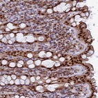 Anti-FAM118B Antibody