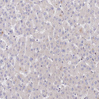 Anti-PPP2R2B Antibody