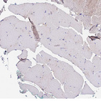 Anti-PPP2R2B Antibody