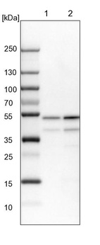 Anti-PPP2R2B Antibody