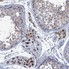 Immunohistochemical staining of human testis shows strong cytoplasmic granular positivity in Leydig cells.