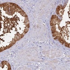 Anti-SFT2D2 Antibody