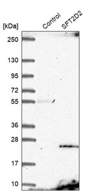 Anti-SFT2D2 Antibody