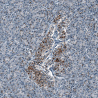 Anti-SCD5 Antibody