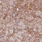 Anti-SPATA2L Antibody