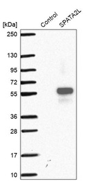 Anti-SPATA2L Antibody