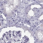 Immunohistochemical staining of human kidney using Anti-SEMG1 antibody HPA042476.