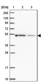 Anti-ICA1L Antibody