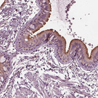 Anti-CCDC114 Antibody