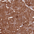 Anti-COG4 Antibody