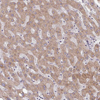 Anti-TAPT1 Antibody