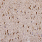 Anti-TAPT1 Antibody