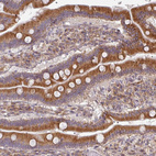 Anti-TAPT1 Antibody