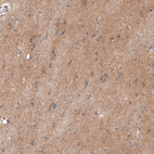 Anti-ENHO Antibody