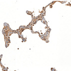 Immunohistochemical staining of human lung shows moderate cytoplasmic positivity in pneumocytes.