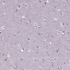 Anti-BANF2 Antibody