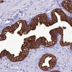 Anti-VPS52 Antibody