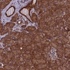 Anti-ANKRD39 Antibody