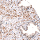 Anti-SMC6 Antibody