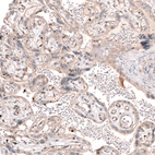 Anti-SMC6 Antibody