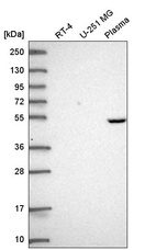 Anti-PDSS1 Antibody