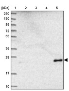 Anti-NDUFB9 Antibody