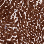 Anti-PPP2R2D Antibody