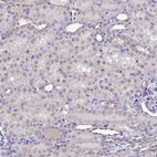 Anti-CMSS1 Antibody