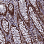 Anti-SF3A2 Antibody