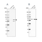 Anti-SF3A2 Antibody