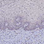 Anti-SLC26A4 Antibody