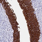 Anti-RBM41 Antibody