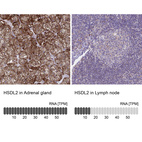 Anti-HSDL2 Antibody