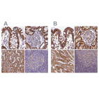 Anti-HSDL2 Antibody