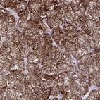 Anti-HSDL2 Antibody