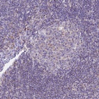 Anti-HSDL2 Antibody