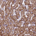 Anti-HSDL2 Antibody