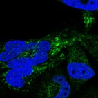 Anti-HSDL2 Antibody