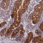 Anti-COQ4 Antibody