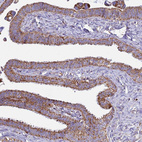 Anti-COQ4 Antibody