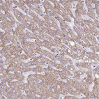 Anti-COQ4 Antibody