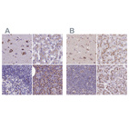 Anti-CASC4 Antibody