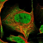 Anti-R3HDM4 Antibody