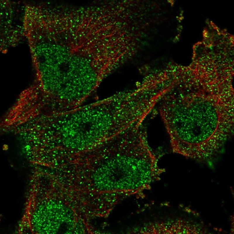 Anti-ELAVL4 Antibody