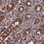 Anti-BPIFB6 Antibody